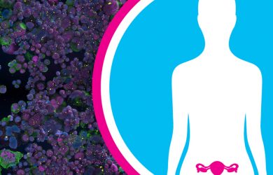 Survivors’ stories: The women helping Cambridge change the future of ovarian cancer