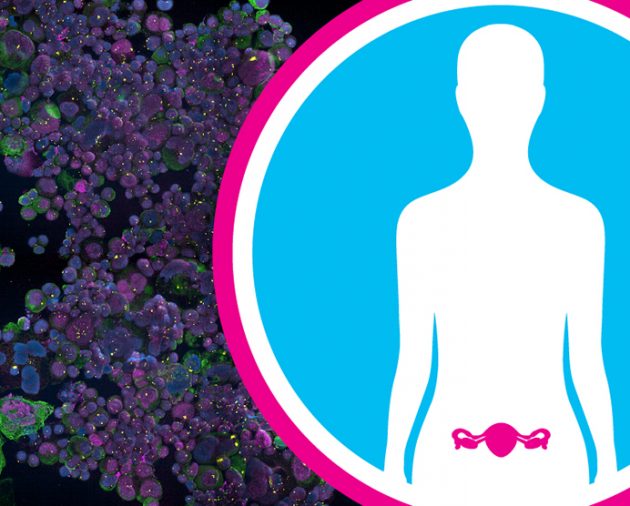 Imaging-based assessment of response to olaparib in platinum-sensitive relapsed ovarian cancer patients