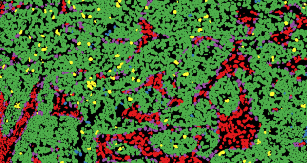 US Dept of Defence funds precision breast cancer research in Cambridge